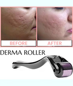 Titanium Micro Needle Derma Roller for Hair, Beard & Skin Care | Acne Scar Removal & Glow Boosting Tool.